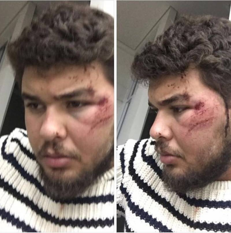 Motorista de Uber mostra marcas da agressão cometida por taxista (Foto: Reprodução)