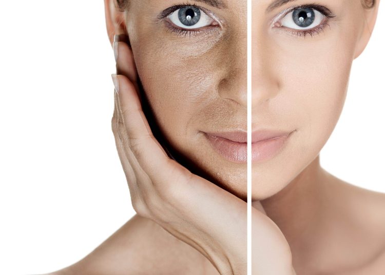 Para cada situação e perfil da pessoa existe um tipo diferente de abordagem e tratamento da mancha na pele | Foto: Reprodução