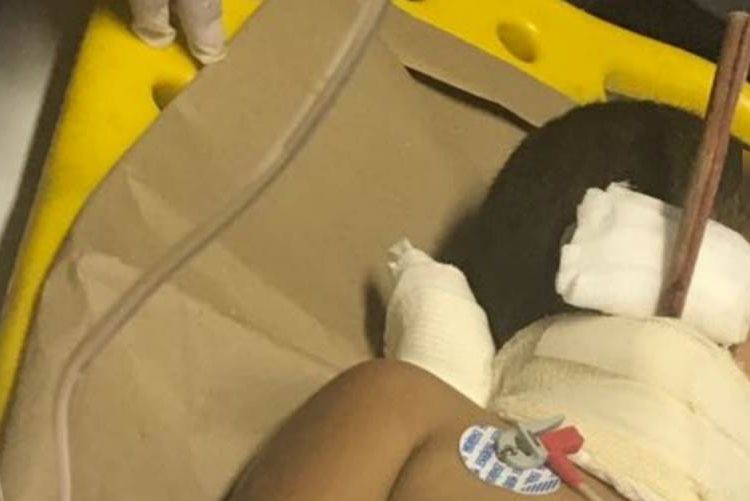 Criança se acidenta com pedaço de madeira em Catalão | Foto: Corpo de Bombeiros