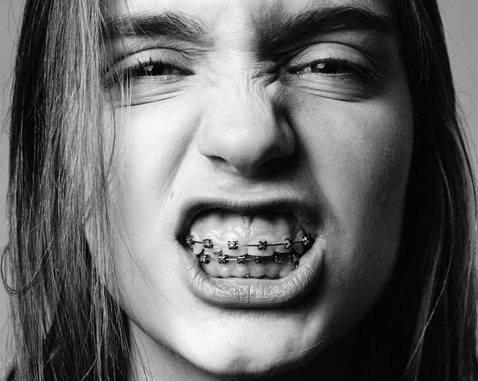 Aparelho pode corrigir outros problemas além da estética? Confira as 7 perguntas e respostas