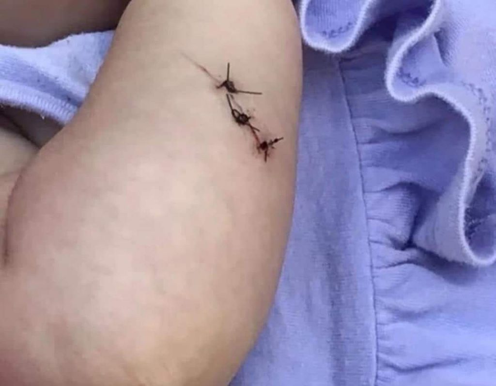 Bebê foi alvo de facada após mãe não ter celular para entregar em assalto | Foto: Reprodução