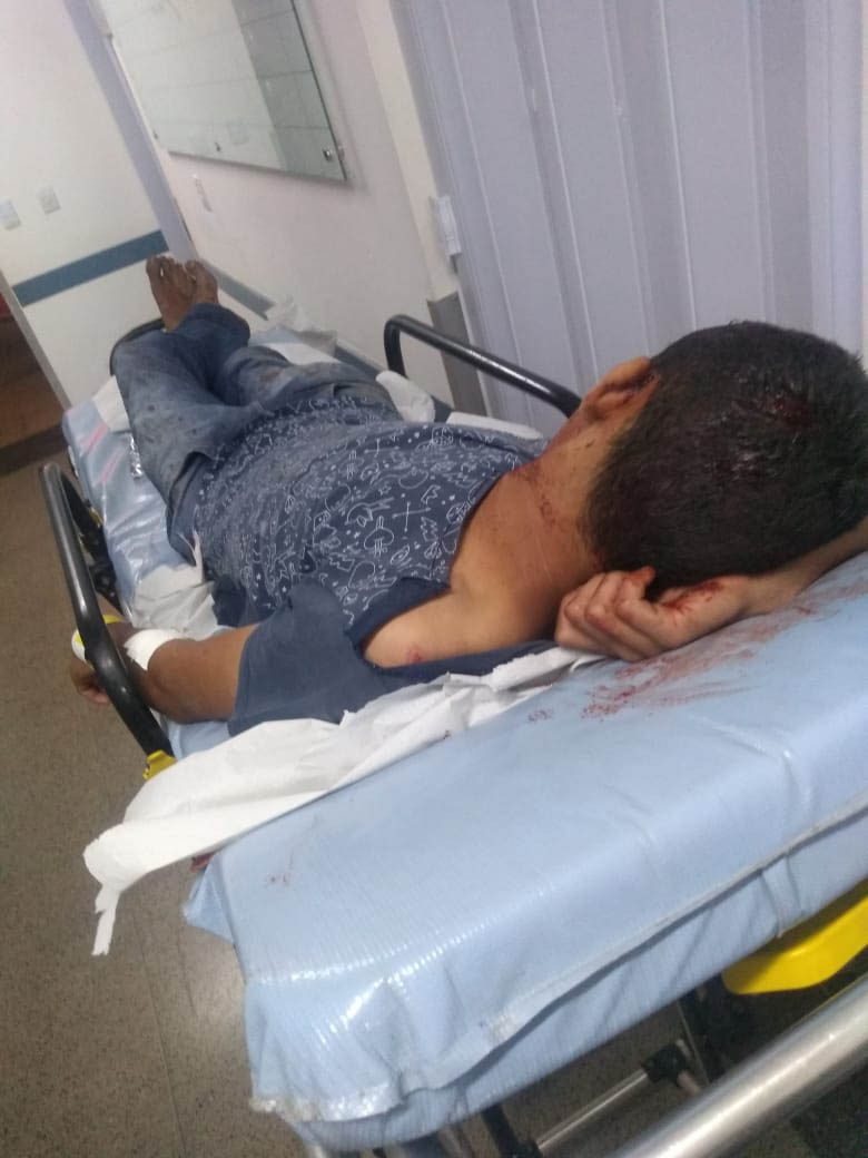 Homem leva paulada de amigo após briga na Cidade Livre