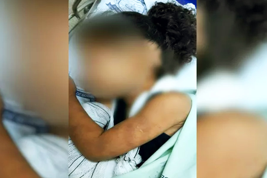 Pai e madrasta são presos suspeitos de espancar e quebrar braço de menina de 4 anos