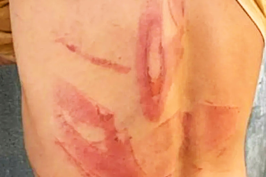 Trabalhadores são torturados por patrões durante 'batismo' em Goiás