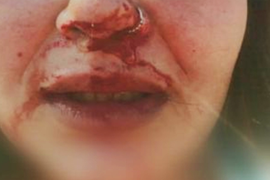 Foto: Divulgação / PCGO