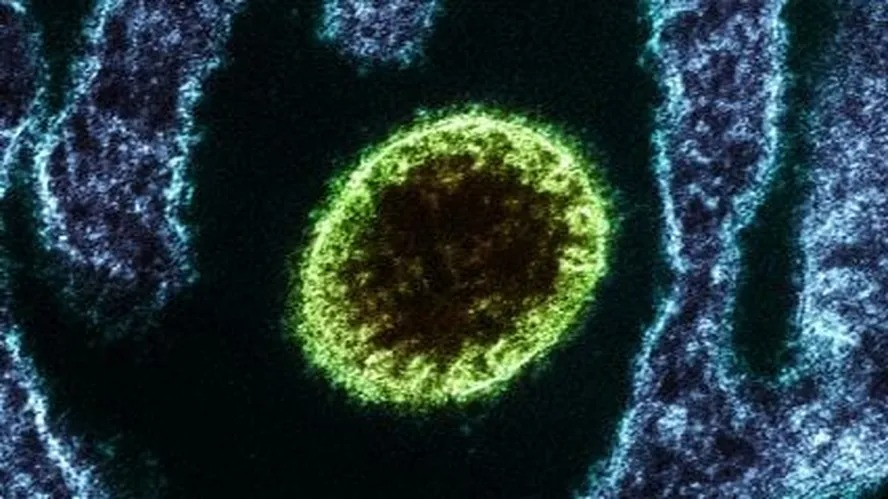 Doença zoonótica que afeta o Sudoeste Asiático desde 1999 | Foto: Reprodução/ Instituto Nacional de Alergia e Doenças Infecciosas dos EUA