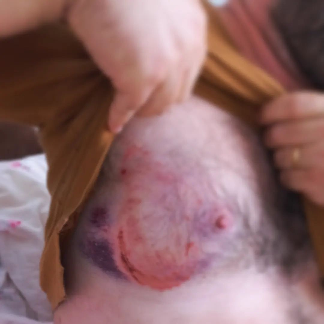 Vereador é mordido por burro no interior do Paraná e fica com hematoma no peito, VEJA IMAGENS